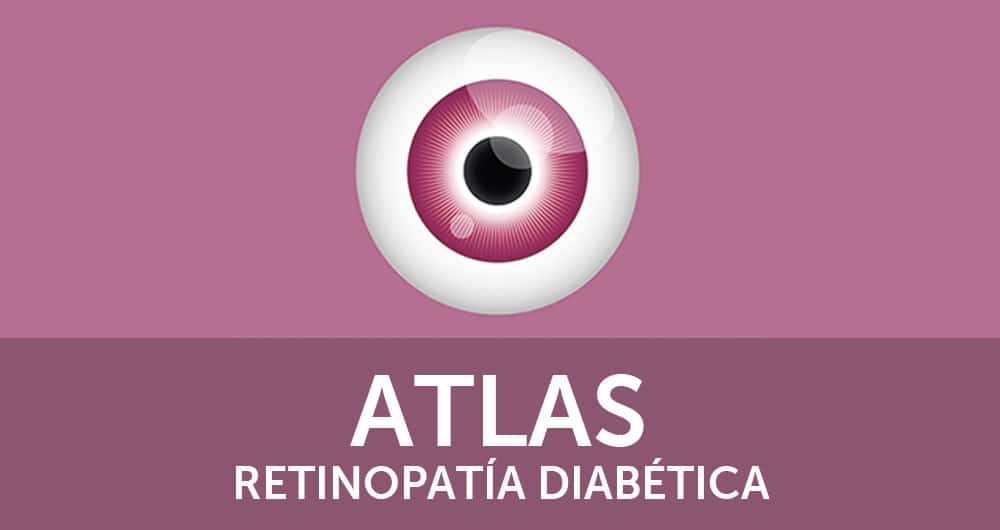 App Atlas de Retinopatía Diabética